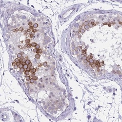 NFXL1 Antibody, Novus Biologicals:Antibodies:Primary Antibodies